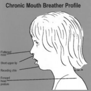 Facial Growth and Development