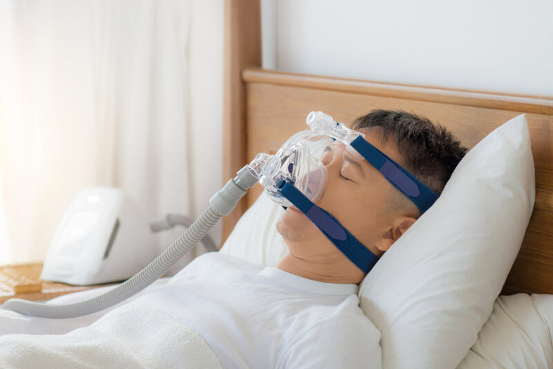 Sleep Apnea - Faceology