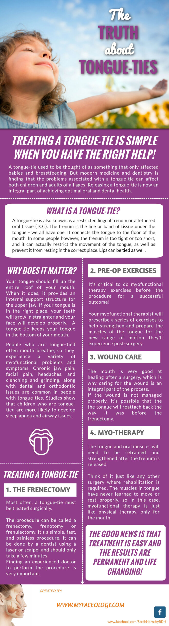 Myofunctional Therapy Infographic The Truth About Tongue Ties Faceology